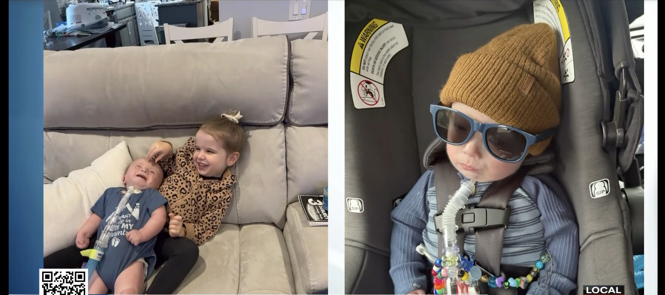 Xander Zeh Trisomie 18