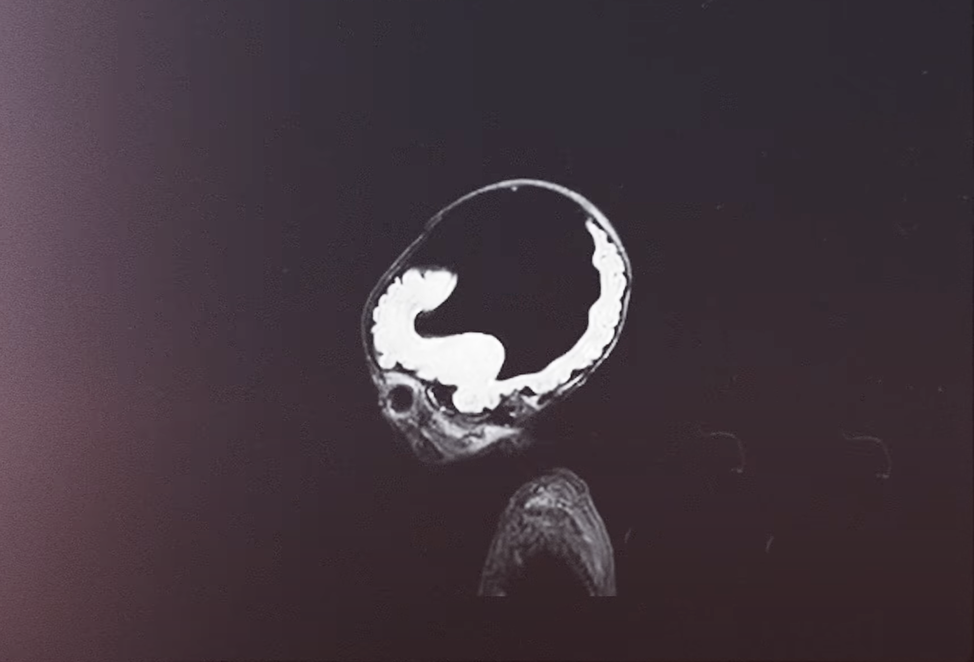 MRT Scan Gehirn Tomek