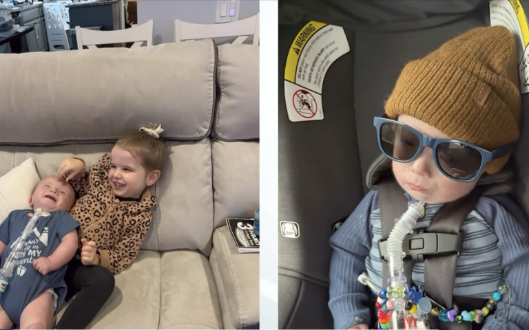 Xander Zeh Trisomie 18